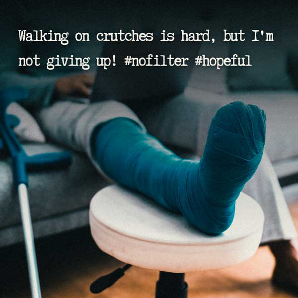 99 Broken Leg Instagram Captions for Motivating Yourself
